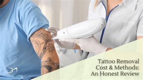 Albuquerque Tattoo Removal Options