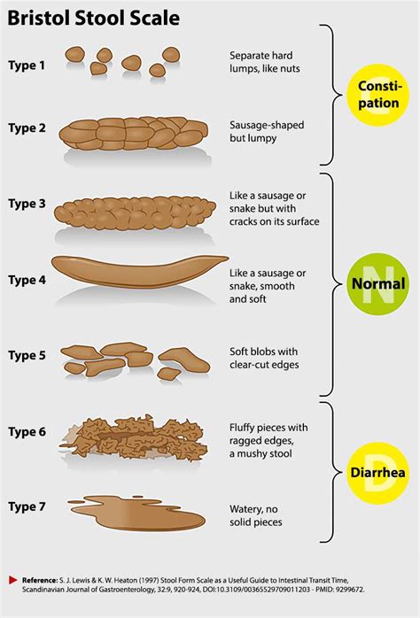 Bristol Stool Chart Explanation