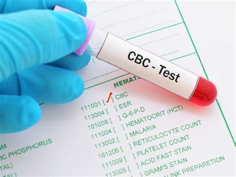 Description of CBC Test Procedure