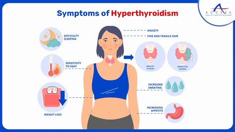 Hyperthyroidism