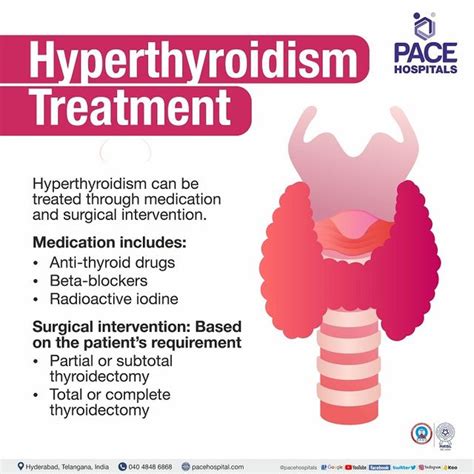 Hyperthyroidism Treatment