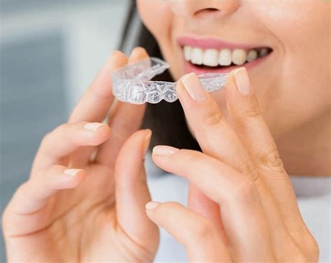 Invisalign at Excel Dental Haverhill Smiles