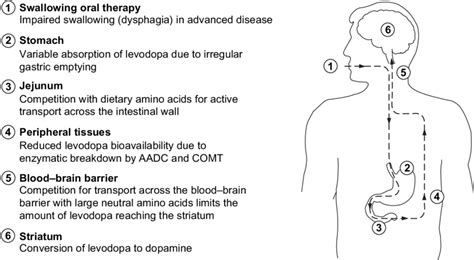 Description of Levodopa Therapy