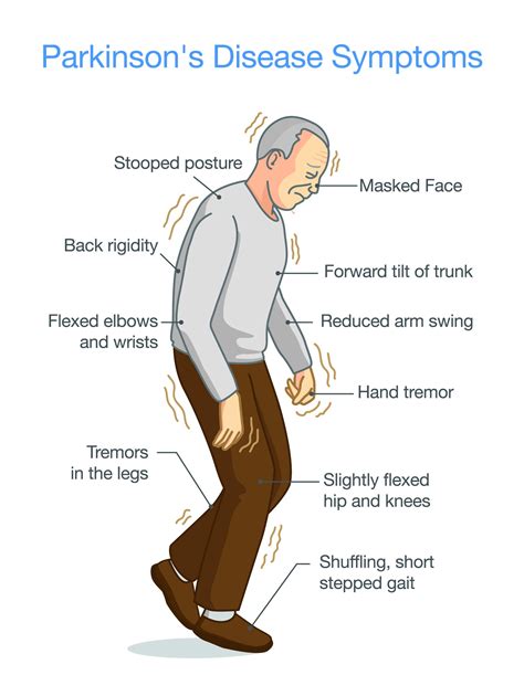 Description of Parkinson's Disease Symptoms