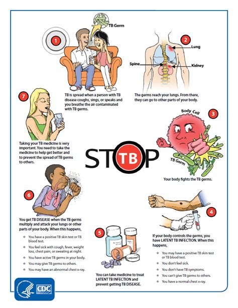 TB Prevention Measures