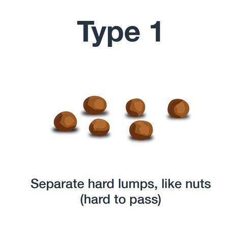 Description of Type 1 Stool