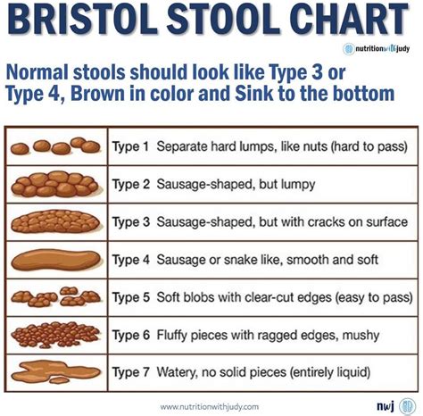 Description of Type 4 Stool