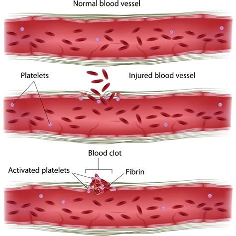 Blood Clotting