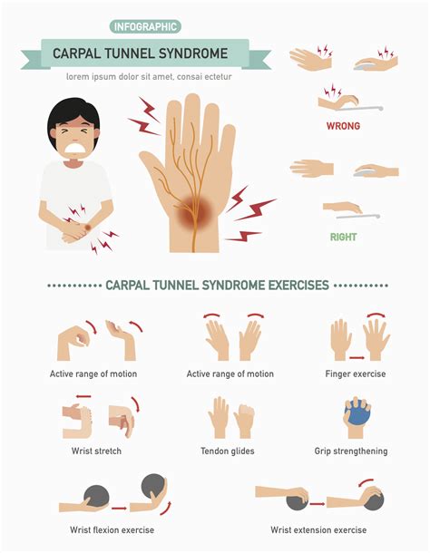 Treatment options for carpal tunnel syndrome