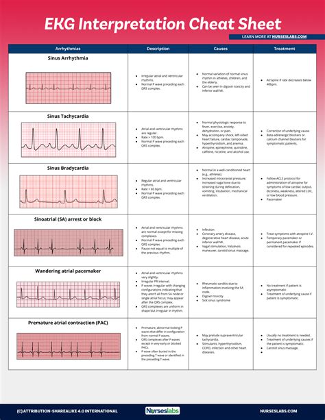 Clinical Significance of EKG Rhythms