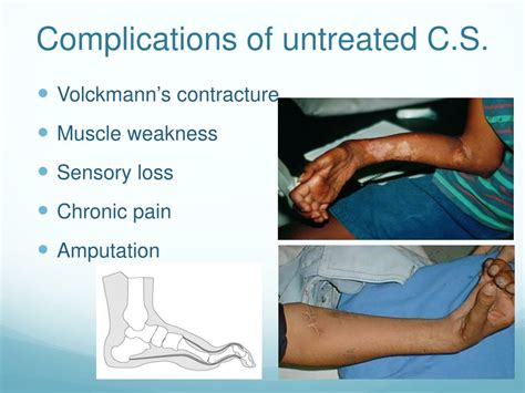 Complications of Compartment Syndrome