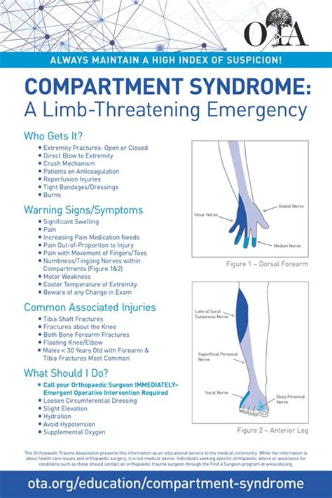 Symptoms of Compartment Syndrome