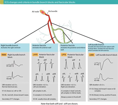 Conduction Defects