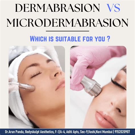 Dermabrasion for tattoo removal