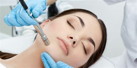 Dermabrasion