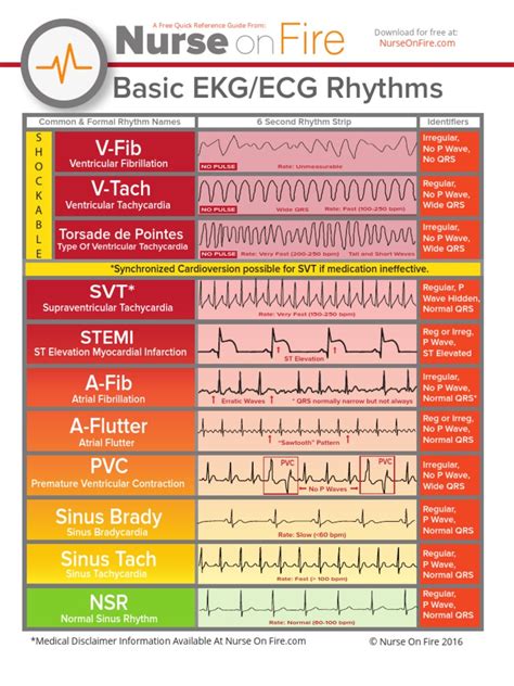 EKG Cheat Sheet Printable