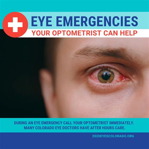 Description of Emergency Eye Care