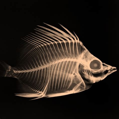 X-ray Image of a Fish