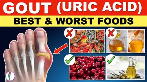 Gout diet image 8