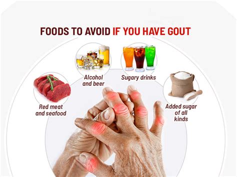 Gout diet image 2