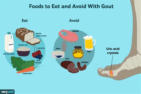 Gout diet image 10