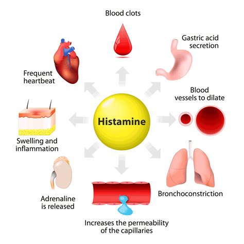 Histamine Intolerance