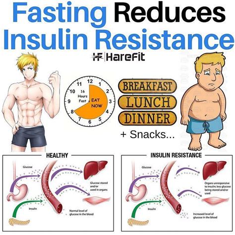 Intermittent Fasting Insulin Sensitivity