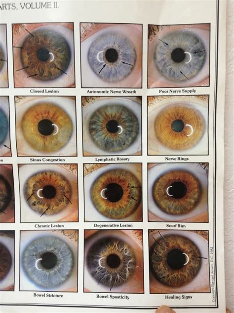 Iridology Colors