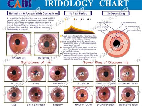 Iridology Training