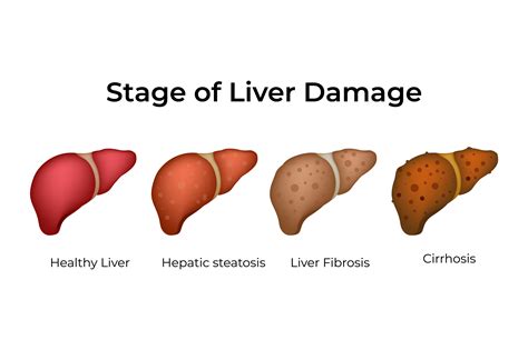 Liver Damage