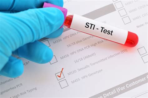 Medical Record of STD Test