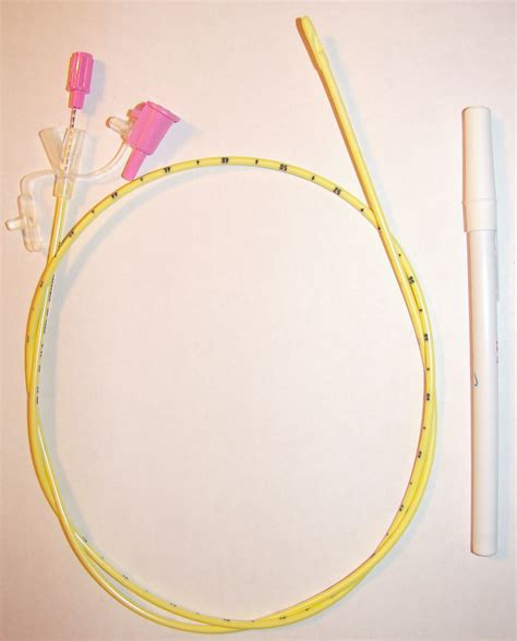 Nasogastric Tube