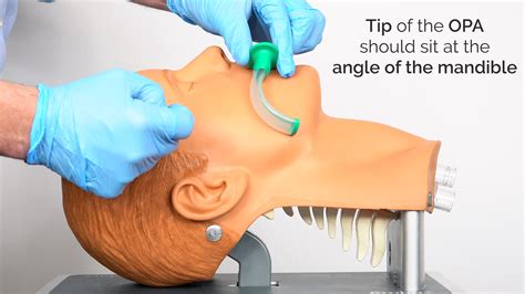 Oropharyngeal airway