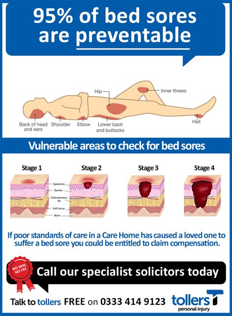 Pressure Ulcer Prevention Template Image 3