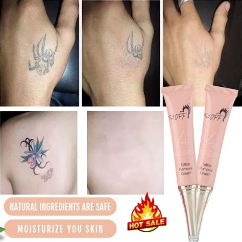 Tattoo Removal Gels