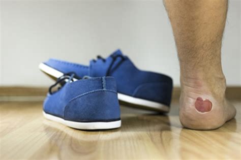 Tips for dealing with blisters