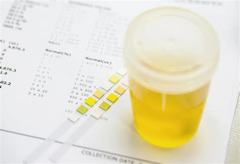 Urine Analysis 8