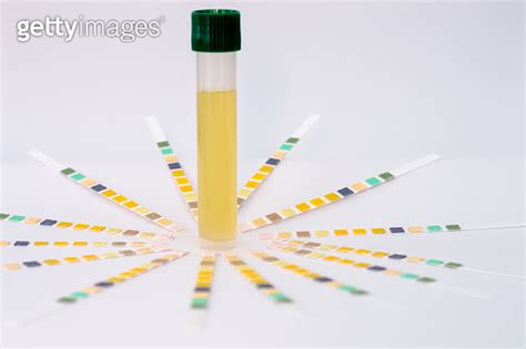 Urine Tests 10